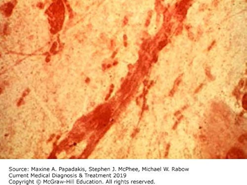 Current Medical Diagnosis &amp; Treatment 2020 [ペーパーバック] Papadakis， Maxine A.， M.D.、 McPhee， Stephen J.， M.D.; Rabow， Michael W.， M.D. Amazon.com: CURRENT Medical Diagnosis and Treatment 2023